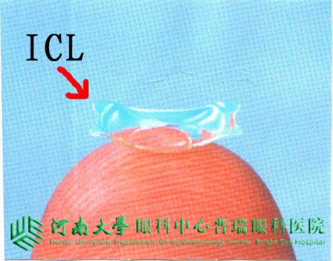 ICL植入術(shù)，高度近視患者的福音