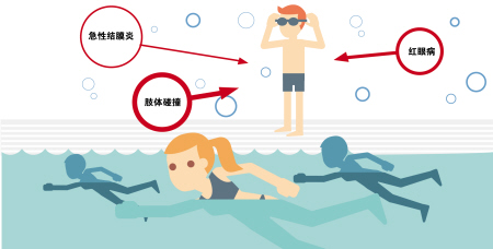 夏季當心紅眼病，網(wǎng)吧泳池成高發(fā)區(qū)