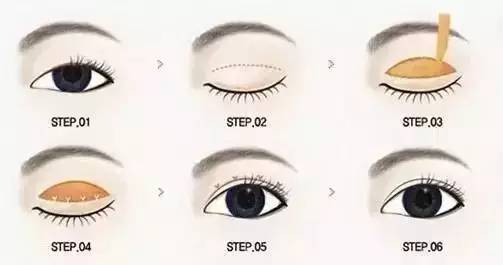 為什么要做雙眼皮？5個(gè)理由說(shuō)服你！