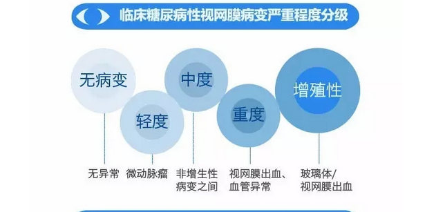 你造嗎？糖尿病晚期眼睛會致盲！