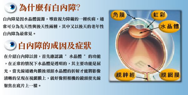 白內障*易忽略的5個常識