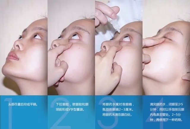 眼藥水你點對了嗎？快來看看！