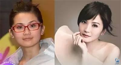 那些近視戴鏡暴丑的女明星們是做了什么變美了？？？